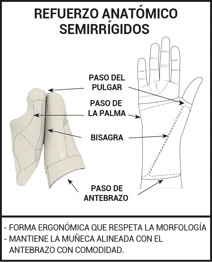 Operarse del síndrome del túnel carpiano - Epitact