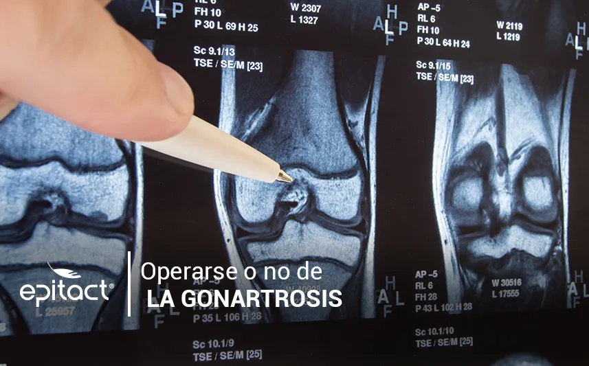 Artrosis o gonartrosis de rodilla. Síntomas y tratamiento